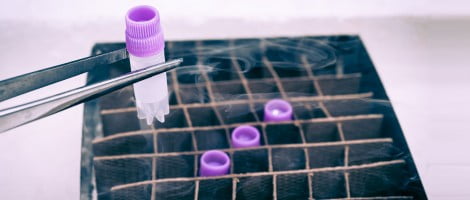 Coste del vial de semen