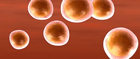 Insuficiencia ovárica