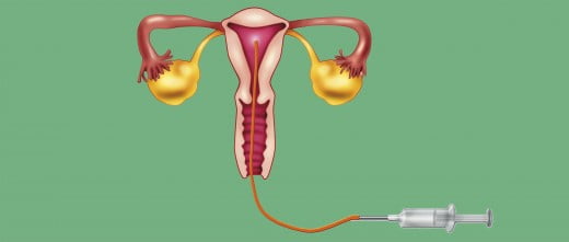 Depositar los espermatozoides