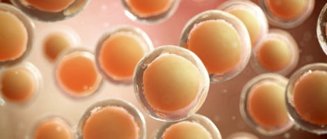 Edad materna avanzada