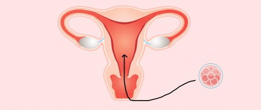 Preparación para la transferencia de embriones