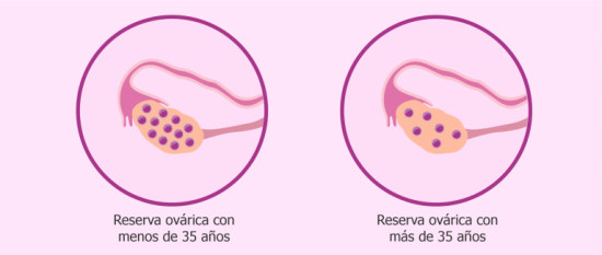 Reserva ovárica y edad