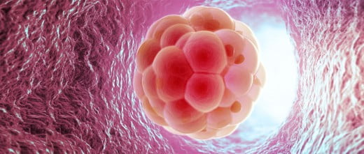 Transferencia embrionaria