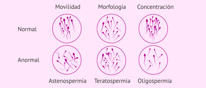Mala calidad del semen