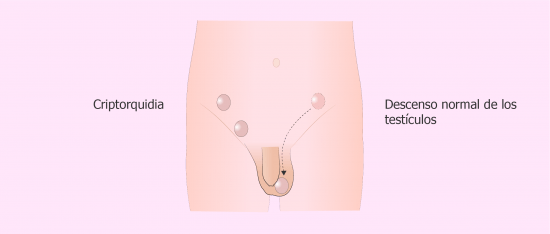 No descenso testicular