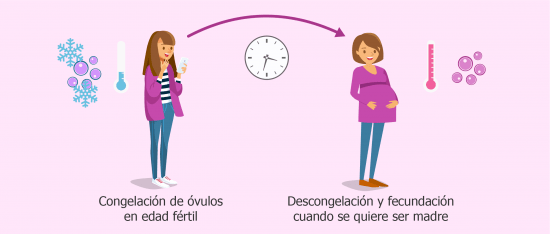Vitrificación de óvulos