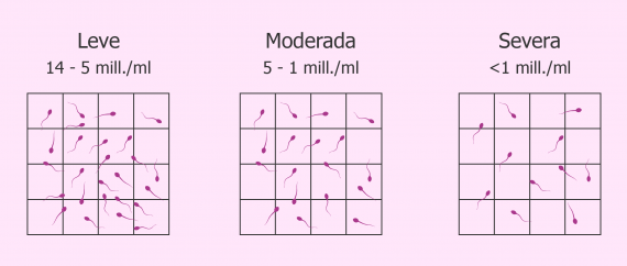 Oligospermia leve, moderada, severa