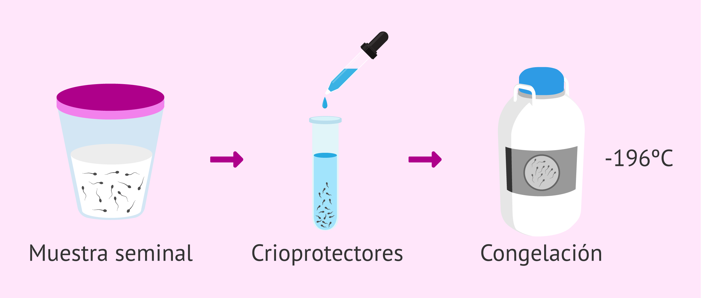 Criopreservación espermática